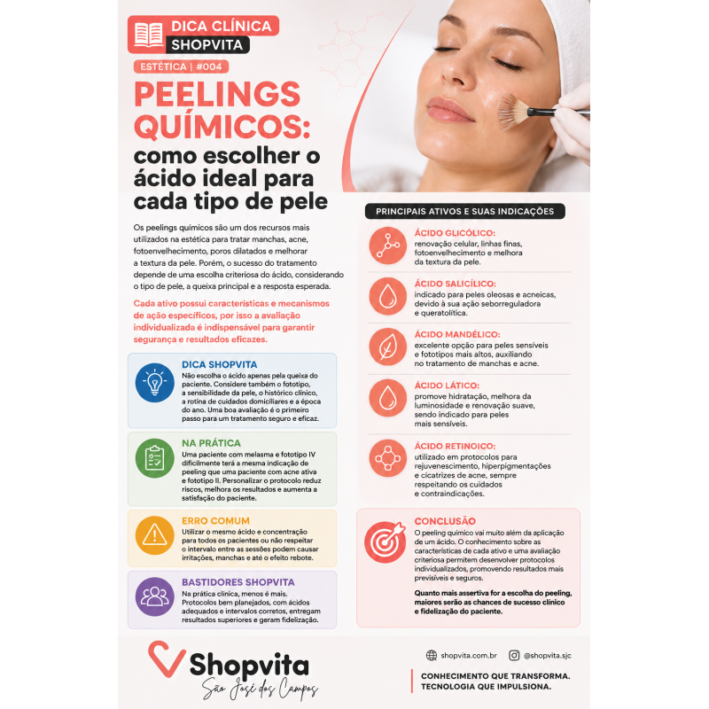Peelings Químicos: Como Escolher o Ácido ideal Para Cada Tipo de Pele